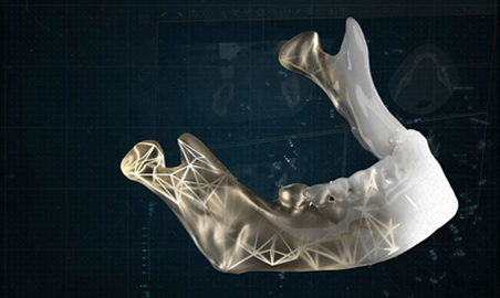3D Planning and 3D Printing at Point-of-Care