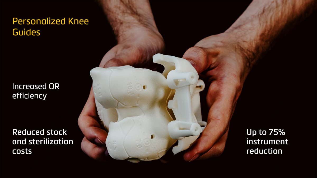 Hands holding personalized knee guide