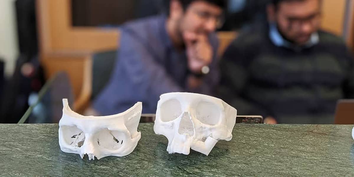 Point-of-Care 3D Printing Lab in India Enables Access to Personalized Treatment