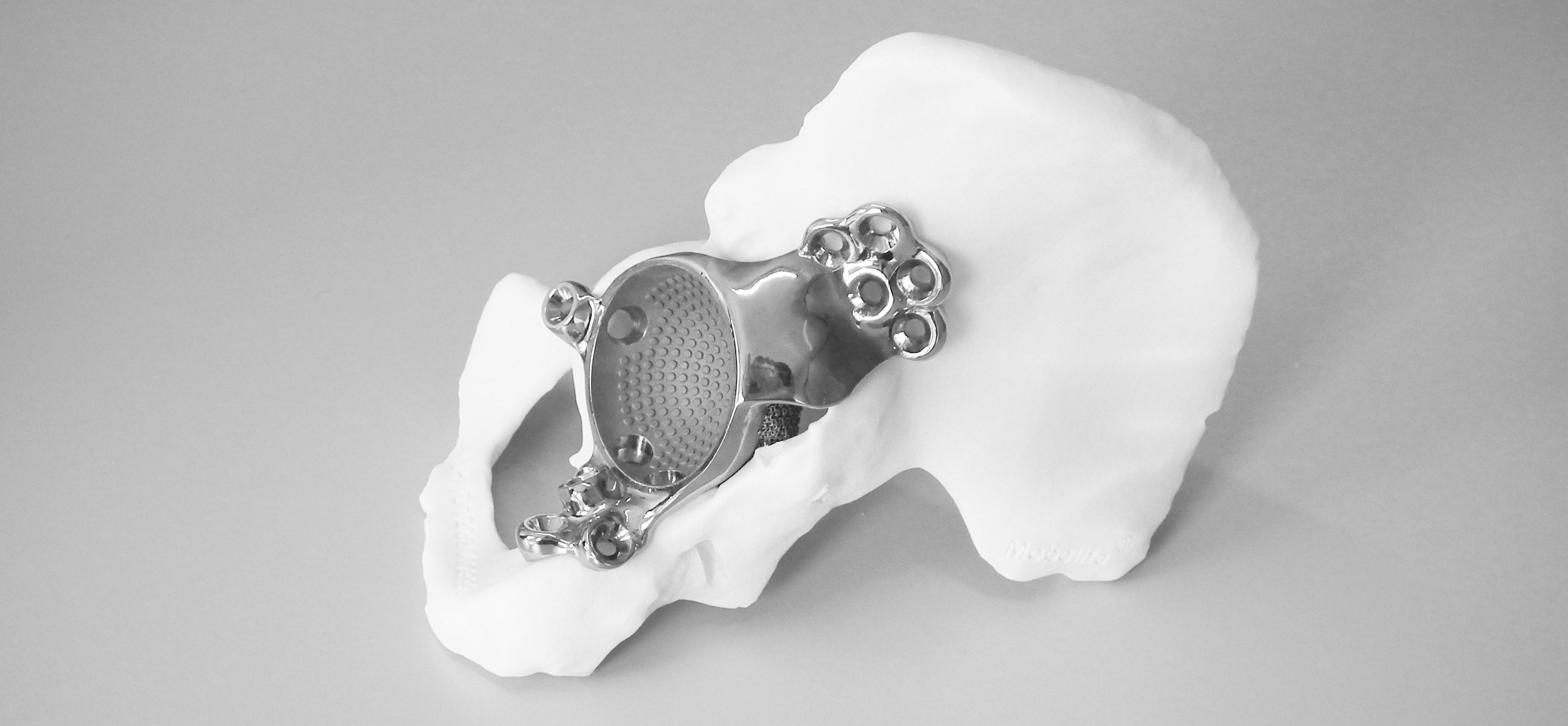 Benefits of 3D-Printed Implants