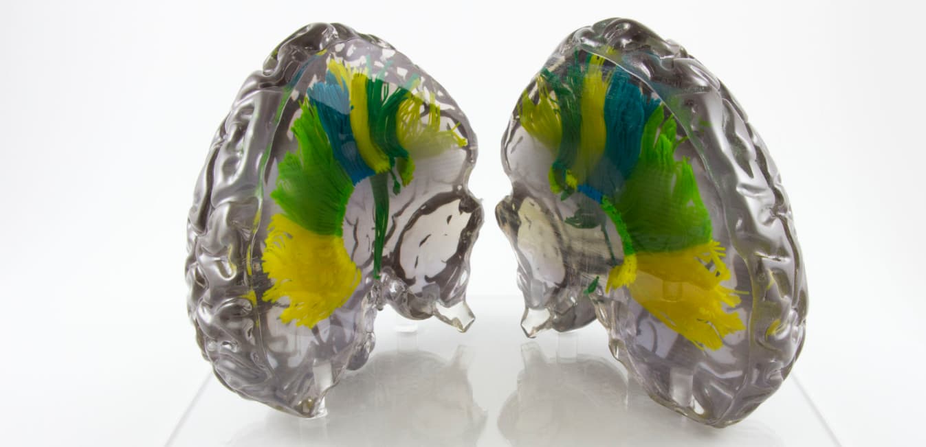 Mehrfarbiges Modell des Gehirns, in 3D gedruckt mit PolyJet 