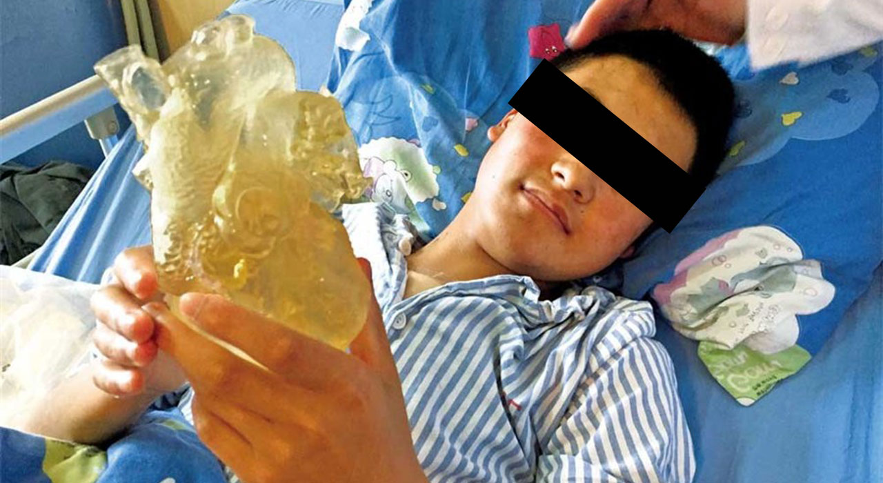 Little Hearts of China Project: 3D-Printed Models Illuminating Complex Pediatric Cases