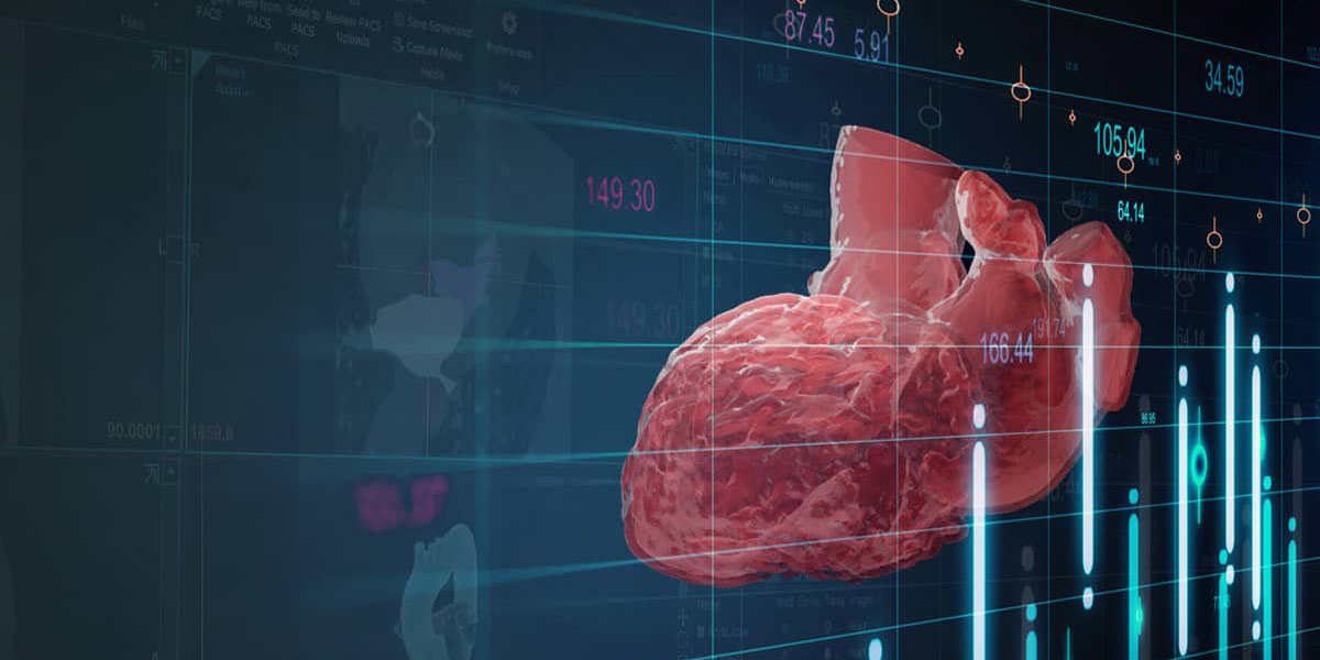 How Automation Helped FEops Accelerate Structural Heart Planning