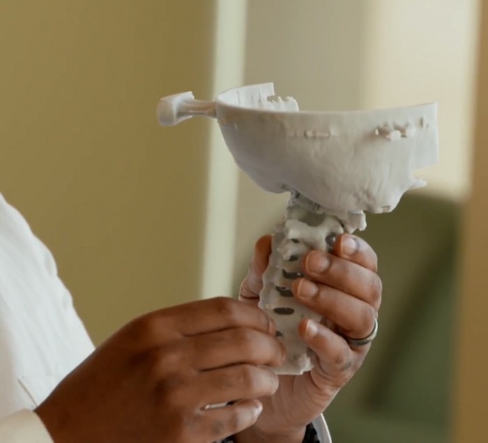 Dr. Sarkar shows the 3D-printed model