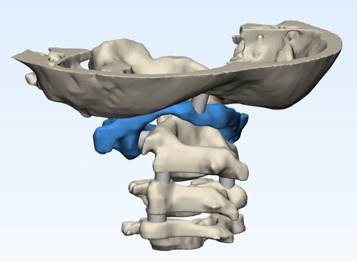 Render of the anatomical model of Jalanea's spine and skull