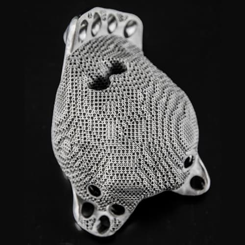 3D Printing in Hip Treatment.jpg