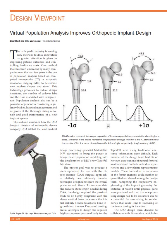 Virtual Population Analysis Improves Orthopedic Implant Design
