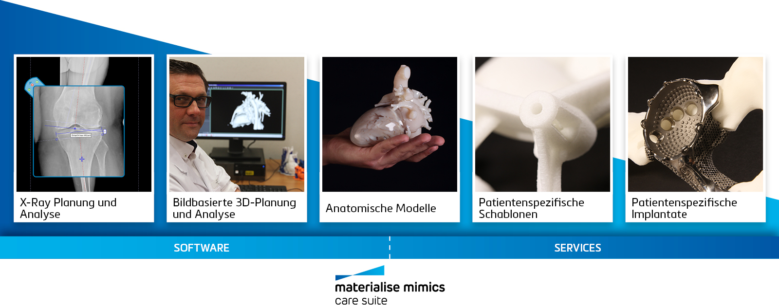 Mimics Care Suite - Von zertifizierter Software über anatomische 3D‑Modelle bis hin zu patientenspezifischen Implantaten und Schablonen