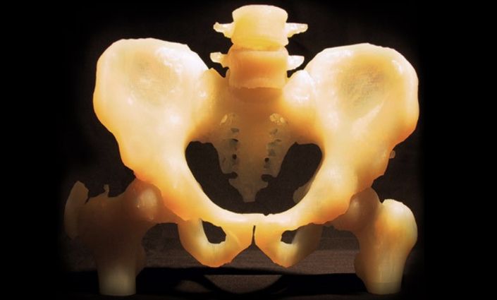 3D-Printed Anatomical Model: Pelvis Model 2004