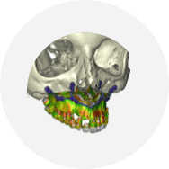 Skull mandible