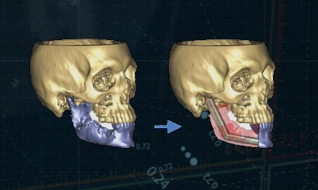 Preoperative visualization of the patient anatomy and condition
