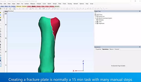How to Automate a Fracture Plate Design Workflow with Scripting