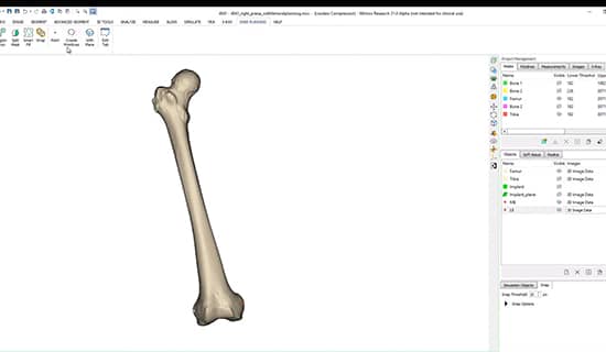 How to plan a knee surgery in Materialise Mimics