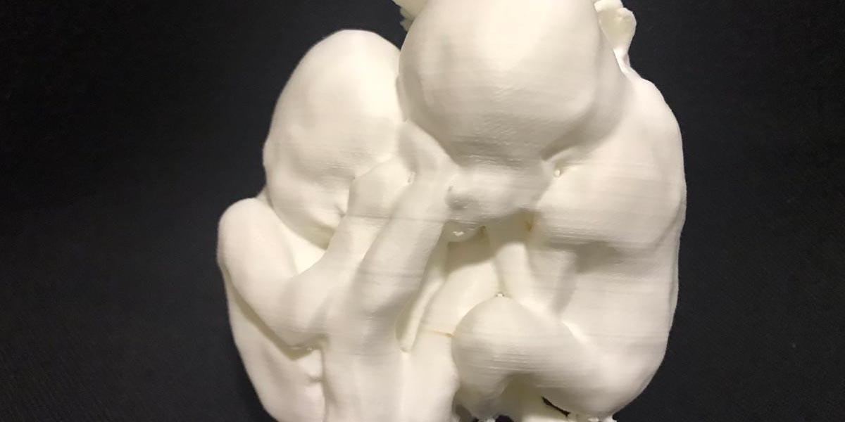 Tecnología 3D en Medicina Fetal