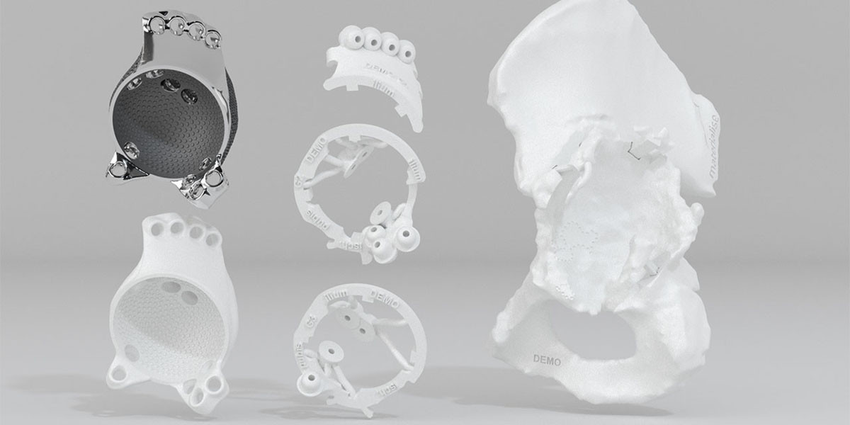 Engineering at the point-of-care with 3D Printing 