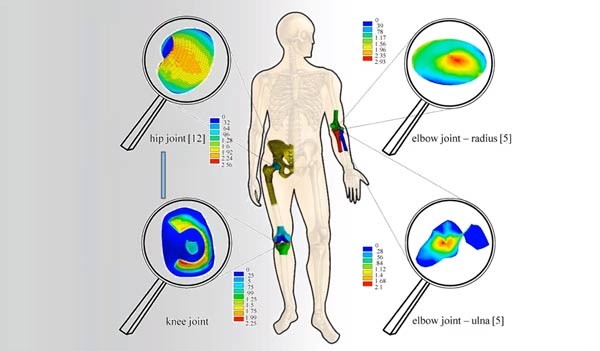 Advancing FEA design through patient-based motion analysis