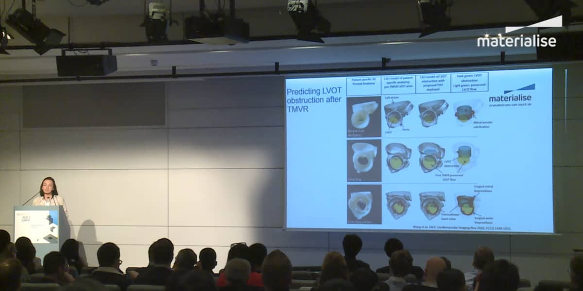 Dr. Wang from the Henry Ford Health System is speaking at the Materialise World Summit in Brussels