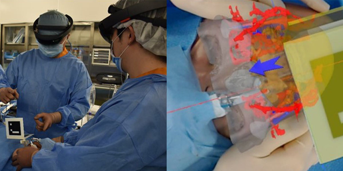 A team of surgeons performs craniomaxillofacial surgery assisted by virtual reality