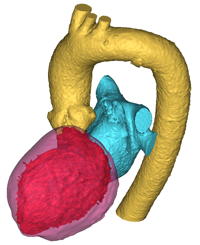 Heart Segmentation: Left Heart and Myocardium