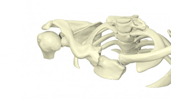 Clavicle reconstruction with 3D printing