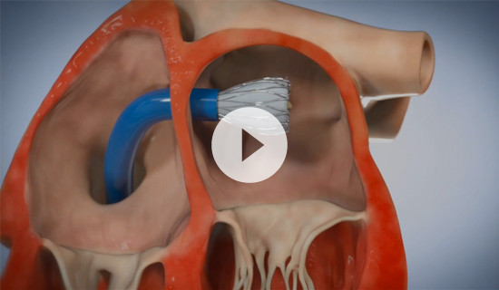 The Value of 3D Printing for  Product & Clinical Development:  4C Medical’s Perspective