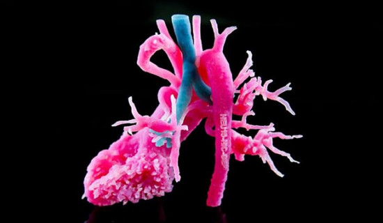 3D Printed Anatomical Models