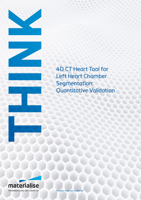 4D CT Heart Tool for Left Heart Chamber Segmentation: Quantitative Validation