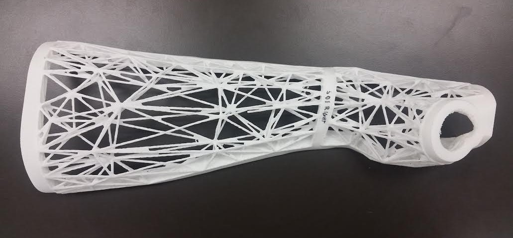 Could 3D Printing Provide an Alternative to Plaster Casts?